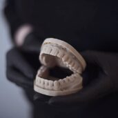 Протезування